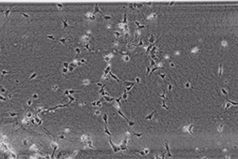 FCS勾配による3DコラーゲンIゲル中の内皮細胞の走化性