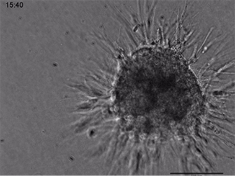 3Dコラーゲンゲル中のHT-1080癌細胞の浸潤