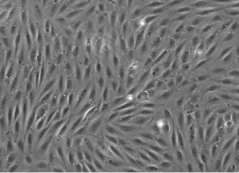 Collagen IVでコーティングしたibidiポリマーカバースリップ上のRAT1細胞