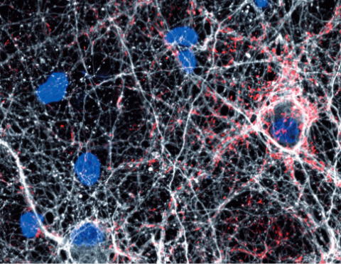 ラット海馬ニューロンとアストロサイト染色