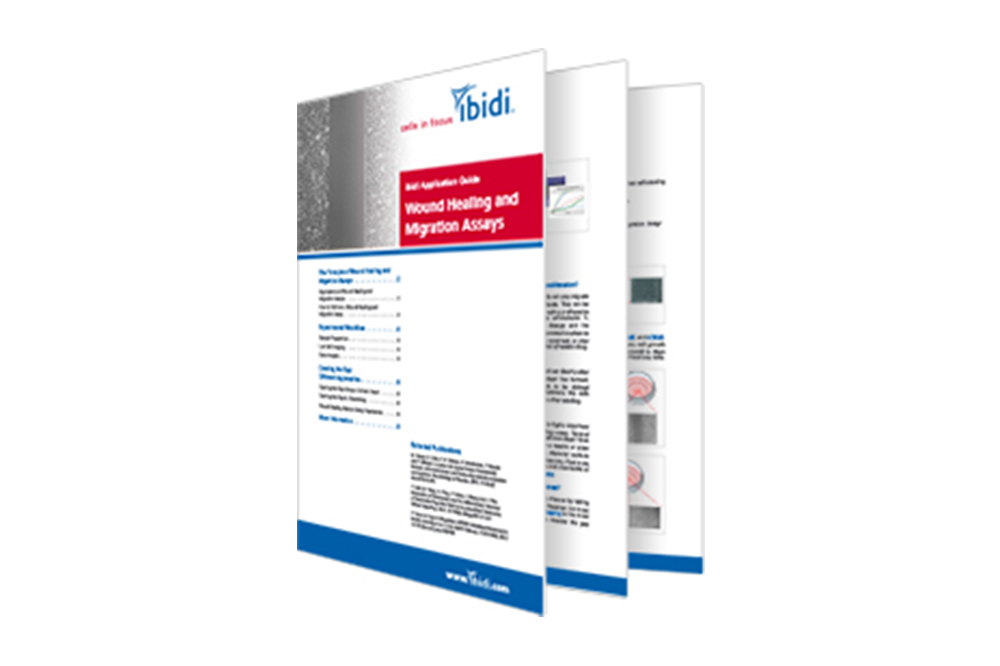 Wound Healing and Migration Assays
