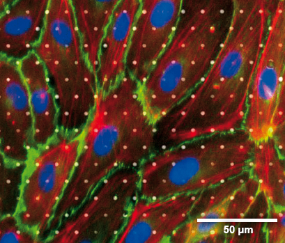 コラーゲン IV コーティングを施した、孔径 3 µm の µ-Slide ibiPore におけるヒト内皮細胞の免疫蛍光染色。 位相コントラスト、DAPI (青)、VE-カドヘリン (緑)、および F アクチン (赤) の重ね合わせ画像。
