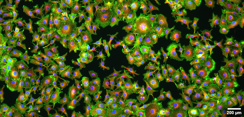 免疫蛍光染⾊後のNIH3T3マウス胎児線維芽細胞の広視野蛍光顕微鏡画像